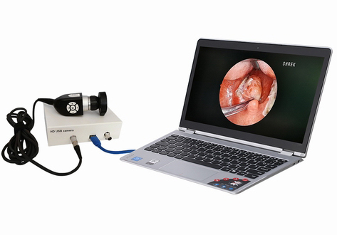 7021 Portable HD Endoscope USB Camera